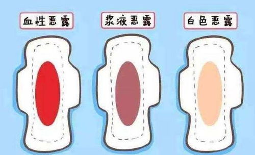 母狗产后多久排恶露