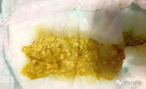 狗狗拉什么样的便便算拉稀