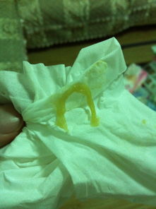 狗狗吃了打虫药多久能吃狗粮