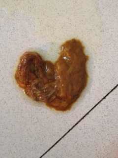 宠物狗拉虫卵怎么办啊