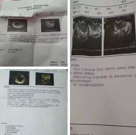 宠物狗囊肿积液怎么办啊