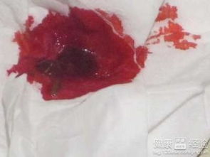 宠物狗肛门带血怎么回事