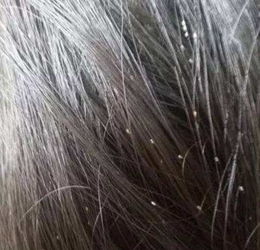 宠物狗长木虱子怎么办啊