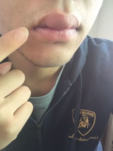 宠物狗嘴唇长痘怎么办啊