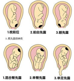 宠物狗胎位不正怎么办呢