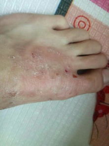 宠物狗的脚痒怎么办啊