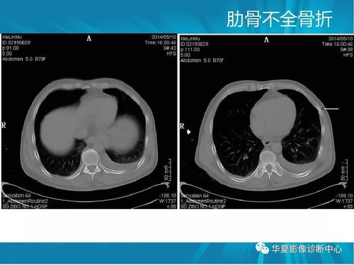 怎么看宠物狗的ct片子