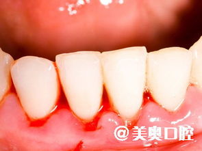 宠物狗牙龈出血怎么办呢