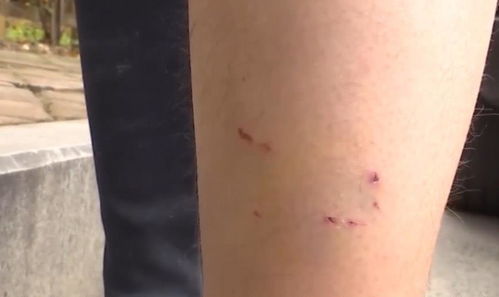 宠物猫咬伤人怎么赔偿