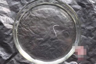 宠物狗排虫卵怎么排的啊