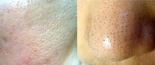 宠物狗粉刺黑头怎么办啊