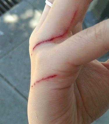 宠物猫抓伤后怎么处理