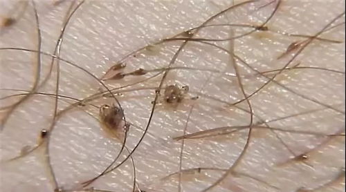 宠物狗长阴虱怎么办啊