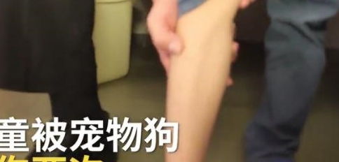 小孩子打宠物狗怎么办