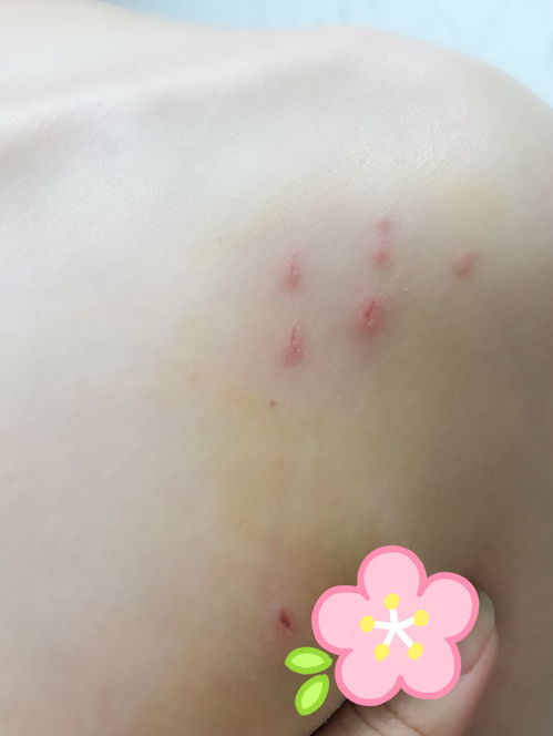 怎么避免宠物猫抓伤自己