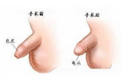 宠物狗包皮过长怎么办啊