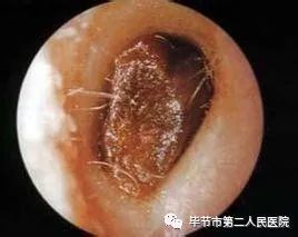 宠物狗耳朵有耳屎怎么办