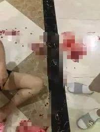 狗休克多久会死亡